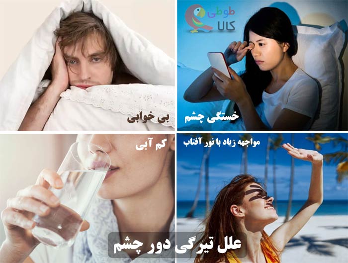 علل تیرگی دور چشم