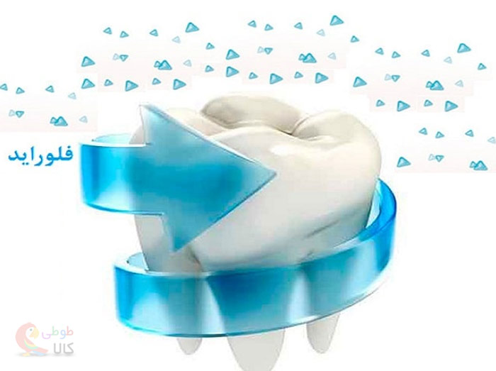 فلوراید دندان