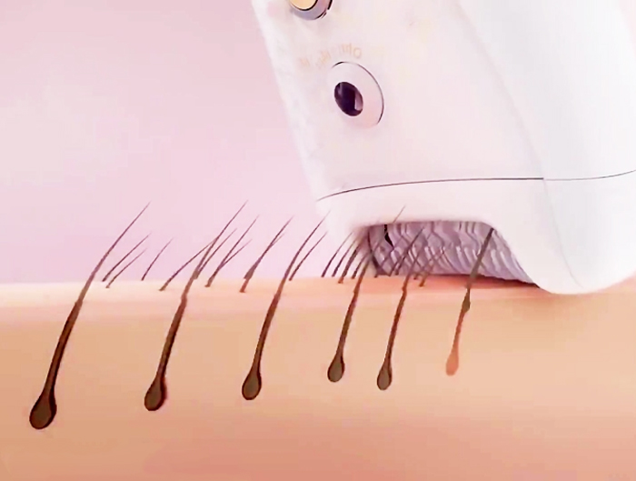 نحوه عملکرد دستگاه اپیلاتور