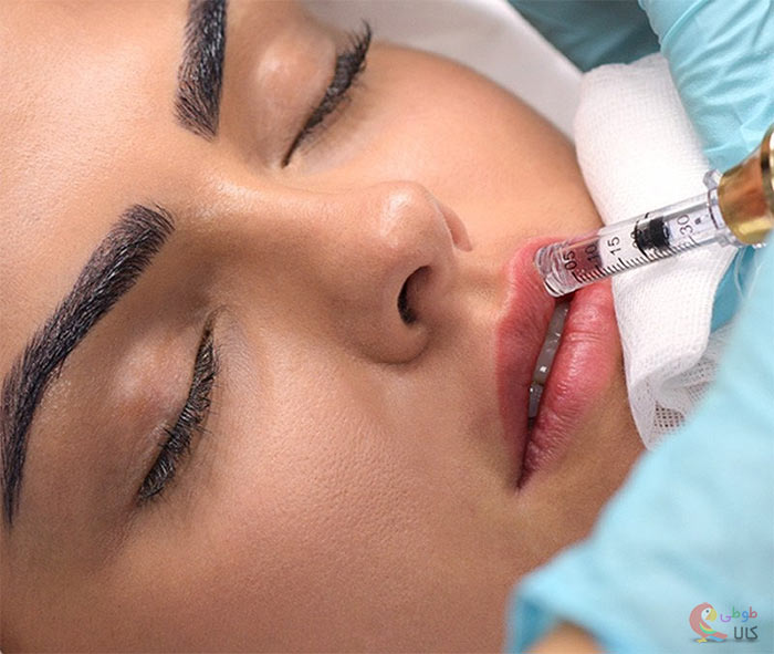 استفاده از روس هیالورون پن برای حجیم تر کردن لبها