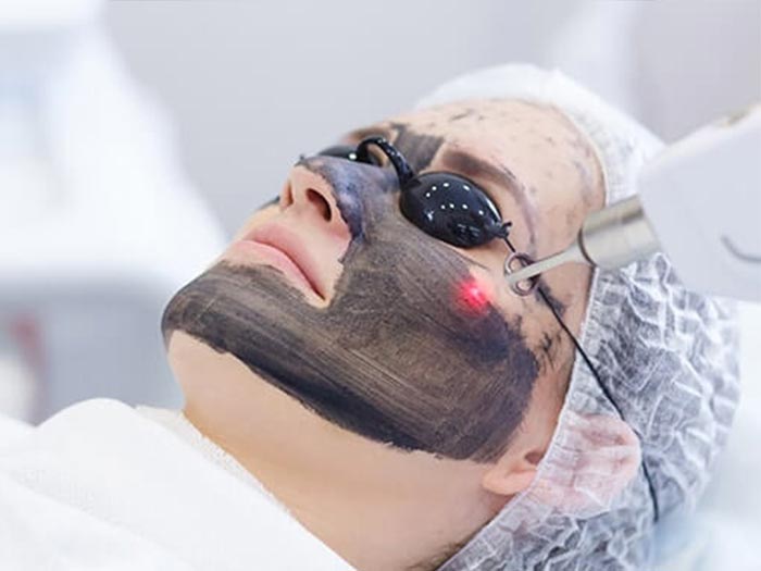 لایه برداری پوست با استفاده از لیزر