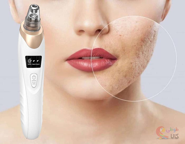 استفاده از میکرودرم ابریژن برای درمان اسکار زخم