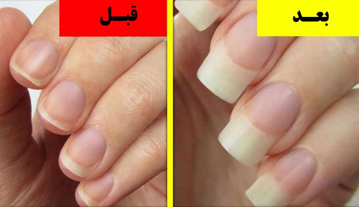 قبل و بعد از استفاده تقویت کننده ناخن