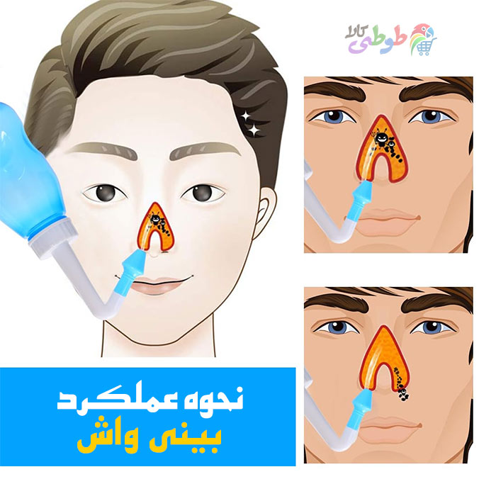 نحوه عملکرد بینی واش