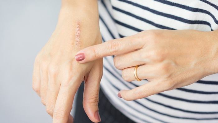 ترمیم زخم روی پوست