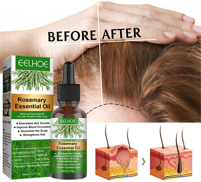 روغن رزماری برای تقویت و رشد مو