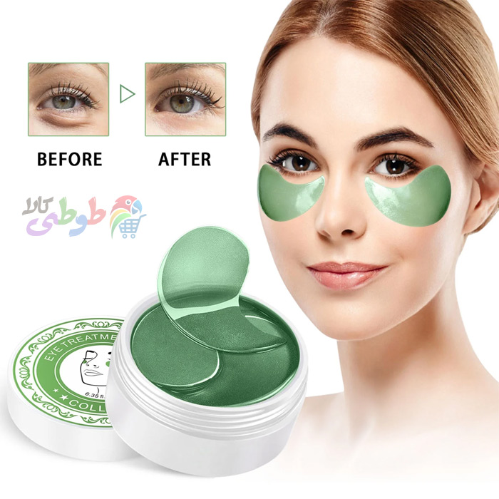 عکس قبل و بعد از استفاده پچ زیر چشم