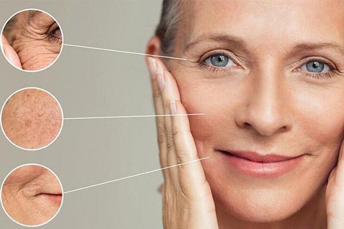 درمان چین و چروک با میکرودرم ابریژن