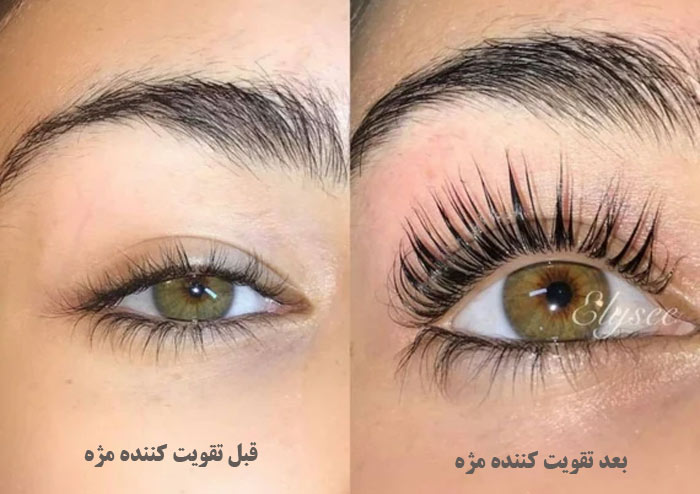 قبل و بعد تقویت کننده مژه