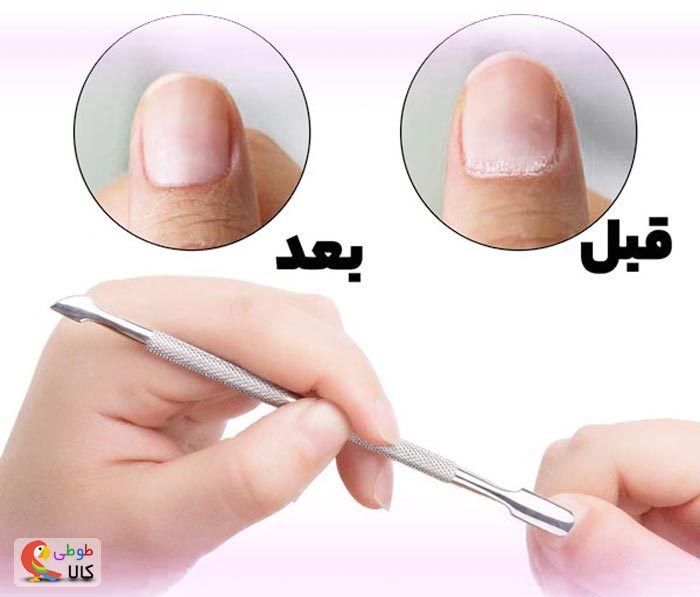 عکس قبل و بعد کاور ناخن