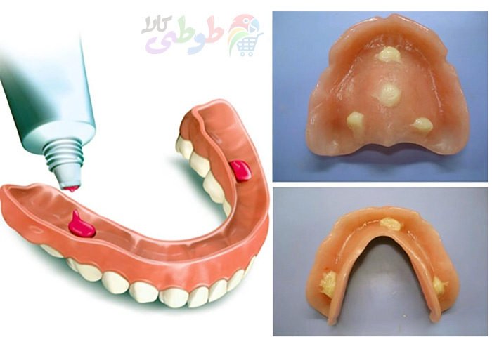عکس چسب دندان مصنوعی