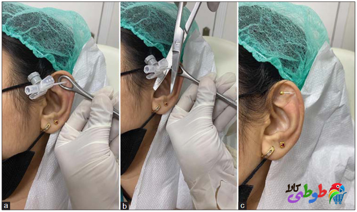 پیرسینگ گوش با انزیوکت