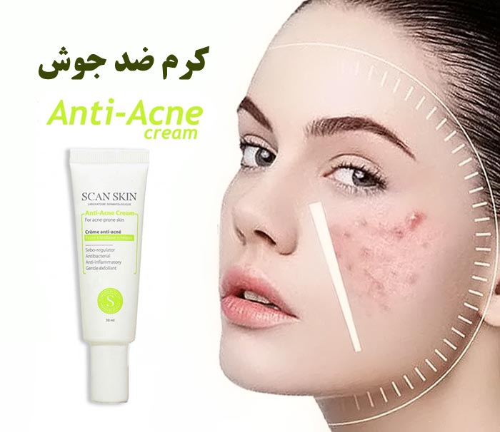 راهنمای خریدکرم ضد جوش