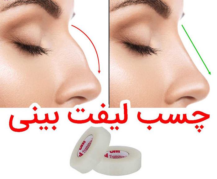 چسب لیفت بینی