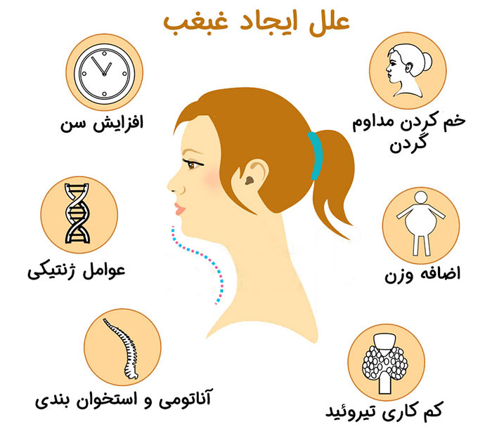 دلایل ایجاد غبغب