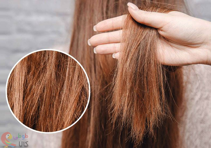 علت خشک شدن موهای سر
