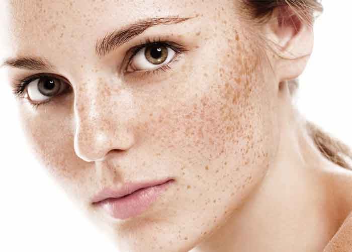 بهترین مدل های کرم ضد لک