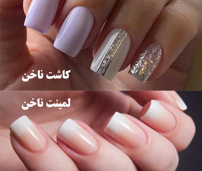 تفاوت کاشت ناخن و لمنیت ناخن