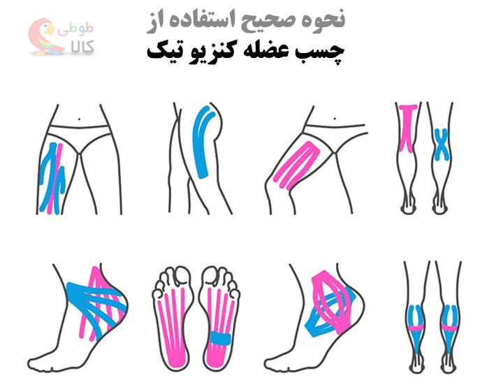 نحوه صحیح استفاده از چسب کنزیو تیپ