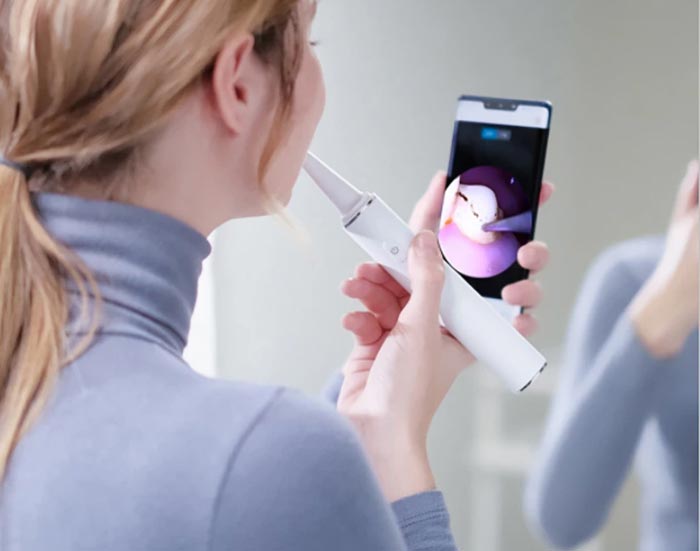 عکس جرم گیر دندان خانگی دوربین دار