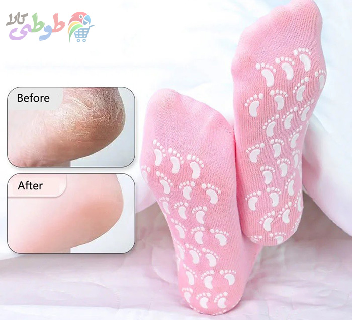 بهترین مدلهای جوراب ضد ترک پا