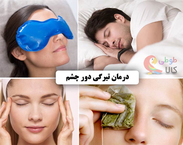 روش های درمان تیرگی دور چشم