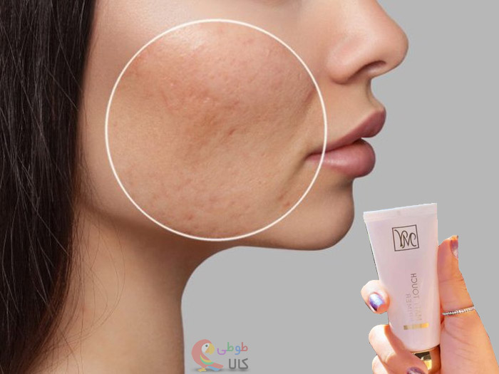 از بین بردن منافذ پوست