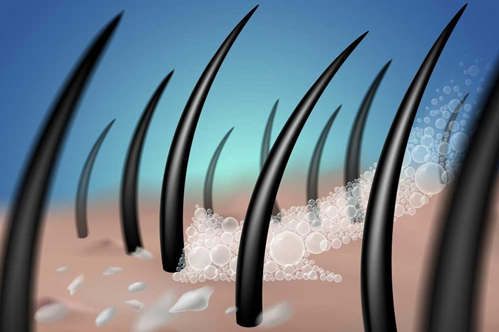 استفاده بیش از حد شامپو