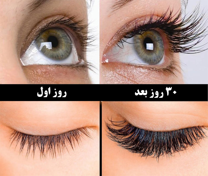 مراحل تقویت پلک