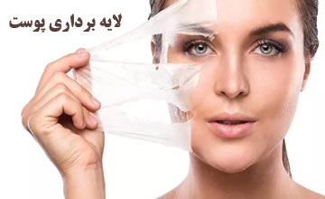 لایه برداری پوست یا پیلینگ چیست و چه فواید و عوارضی دارد؟