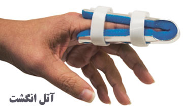 بررسی انواع آتل شکستگی انگشت دست و مدت زمان بستن آن