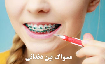 مسواک بین دندانی چیست و طرز استفاده از آن چگونه است؟
