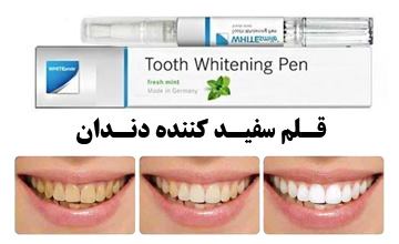 قلم سفید کننده دندان چیست و چگونه از آن استفاده می شود؟