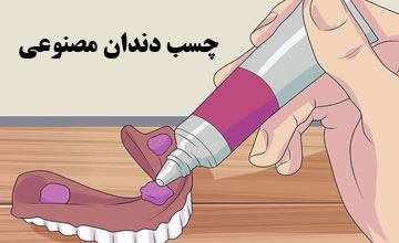 چسب دندان مصنوعی چیست و چقدر دوام دارد؟ بررسی عوارض و طرز استفاده