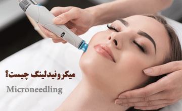 میکرونیدلینگ چیست و چگونه انجام میشود؟ بررسی فواید و عوارض