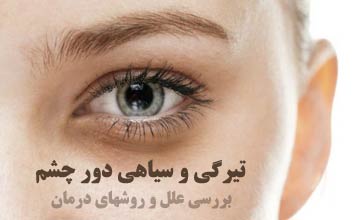 علت سیاهی دور چشم چیست و چگونه آن را درمان کنیم؟