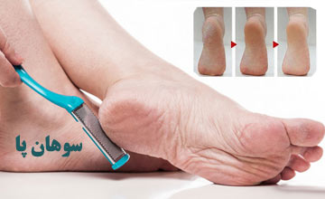 سوهان پا چیست و طرز استفاده صحیح از آن چگونه است؟