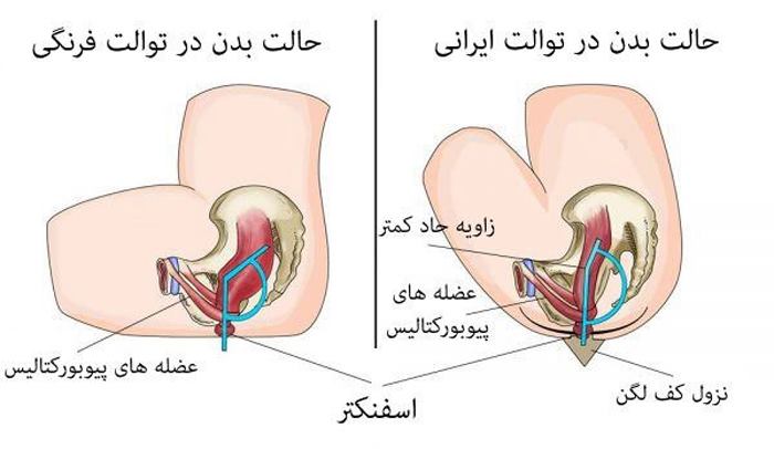 مضرات توالت فرنگی