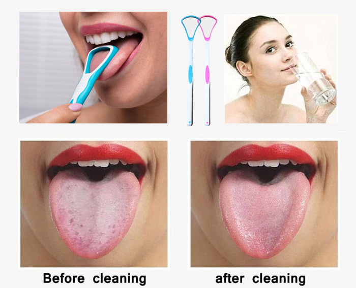 فواید استفاده از مسواک زبان