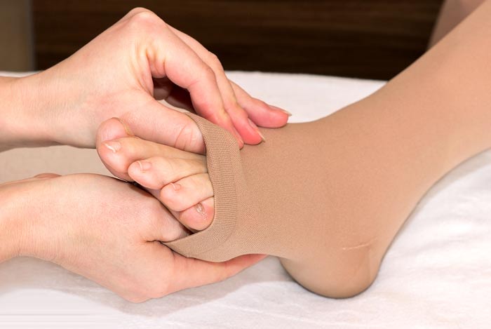 نحوه پوشیدن جوراب واریس