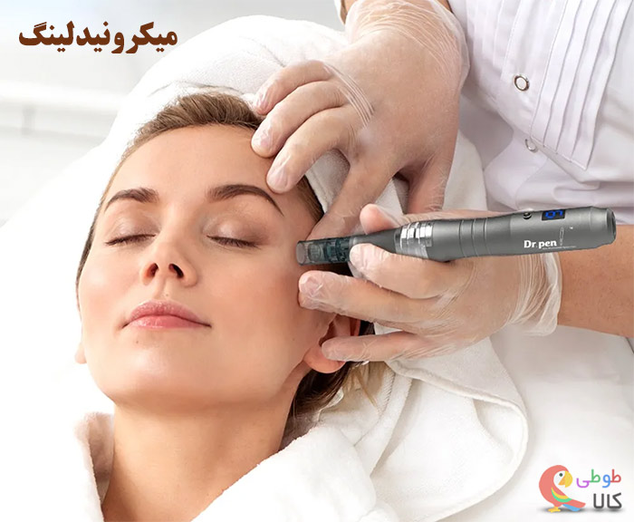 میکرونیدلینگ